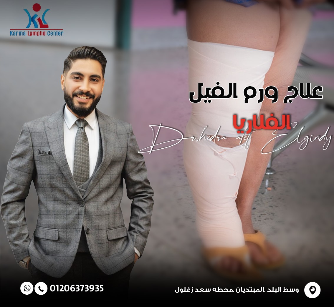 مركز الكرمه لعلاج مرض الفيل