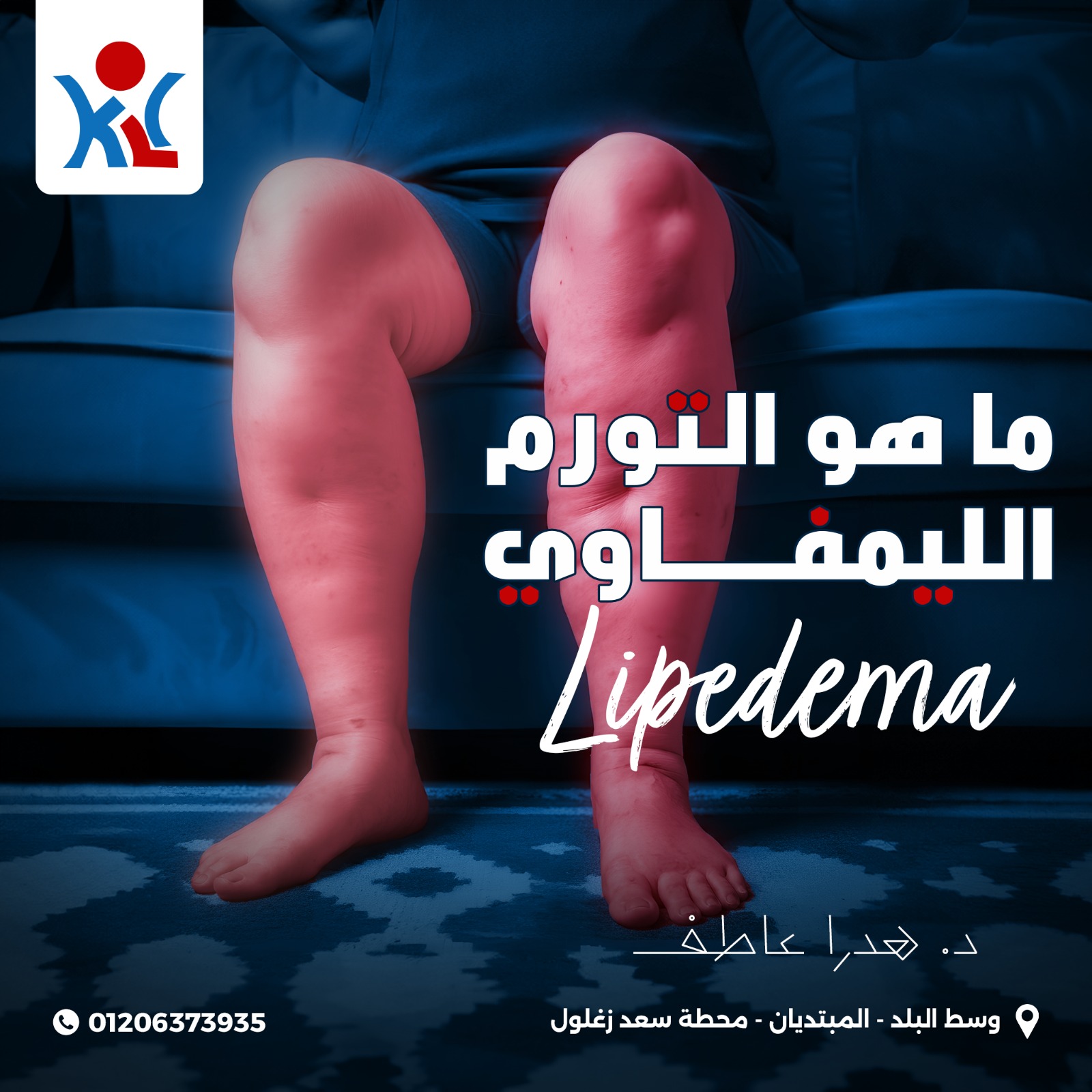 مركز الكرمه لعلاج مرض الفيل<